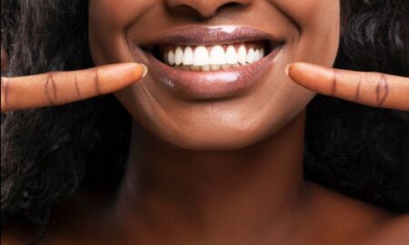Ein strahlendes Lächeln: Das MySmile-Zahnparadigma